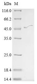 (Tris-Glycine gel) Discontinuous SDS-PAGE (reduced) with 5% enrichment gel and 15% separation gel.