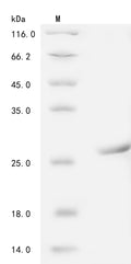 (Tris-Glycine gel) Discontinuous SDS-PAGE (reduced) with 5% enrichment gel and 15% separation gel.