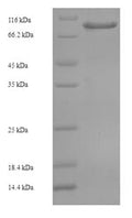 Recombinant Human Coiled-coil domain-containing protein 36 (CCDC36), partial – Figure 1 of 1