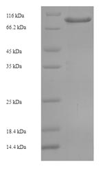 Recombinant Human Coiled-coil domain-containing protein 36 (CCDC36), partial – Figure 1 of 1