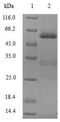 (Tris-Glycine gel) Discontinuous SDS-PAGE (reduced) with 5% enrichment gel and 15% separation gel.