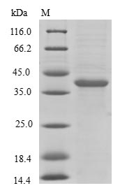 (Tris-Glycine gel) Discontinuous SDS-PAGE (reduced) with 5% enrichment gel and 15% separation gel.
