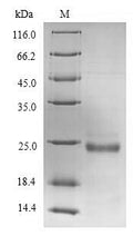 Recombinant Human von Willebrand factor A domain-containing protein 5B2 (VWA5B2), partial – Figure 1 of 1