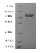 Recombinant Human Acyl-CoA-binding domain-containing protein 4 (ACBD4) – Figure 1 of 1