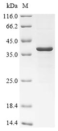 (Tris-Glycine gel) Discontinuous SDS-PAGE (reduced) with 5% enrichment gel and 15% separation gel.