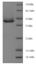 Recombinant Human Apoptosis-enhancing nuclease (AEN), partial – Figure 1 of 1
