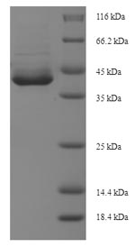 Recombinant Human Apoptosis-enhancing nuclease (AEN), partial – Figure 1 of 1