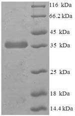 Recombinant Human Phosphatidylglycerophosphatase and protein-tyrosine phosphatase 1 (PTPMT1) – Figure 1 of 1