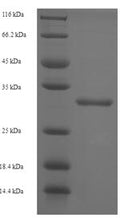 Recombinant Human CMP-N-acetylneuraminate-poly-alpha-2,8-sialyltransferase (ST8SIA4) – Figure 1 of 1