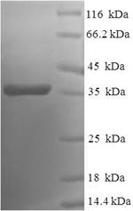 Recombinant Human Bcl-2-like protein 2 (BCL2L2) – Figure 1 of 1