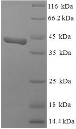 Recombinant Human SWI/SNF complex subunit SMARCC1 (SMARCC1), partial – Figure 1 of 1