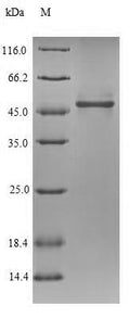 (Tris-Glycine gel) Discontinuous SDS-PAGE (reduced) with 5% enrichment gel and 15% separation gel.