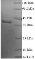Recombinant Human Sentrin-specific protease 8 (SENP8) – Figure 1 of 1