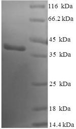 Recombinant Human Sentrin-specific protease 8 (SENP8) – Figure 1 of 1