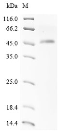 (Tris-Glycine gel) Discontinuous SDS-PAGE (reduced) with 5% enrichment gel and 15% separation gel.