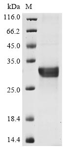(Tris-Glycine gel) Discontinuous SDS-PAGE (reduced) with 5% enrichment gel and 15% separation gel.