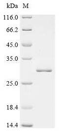 (Tris-Glycine gel) Discontinuous SDS-PAGE (reduced) with 5% enrichment gel and 15% separation gel.