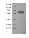 Recombinant Human Uncharacterized protein C20orf197 (C20orf197) – Figure 1 of 1