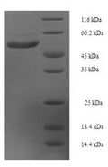 Recombinant Human Interleukin-22 receptor subunit alpha-1 (IL22RA1), partial – Figure 1 of 1