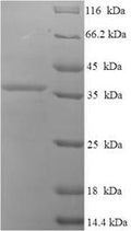 Recombinant Human Uncharacterized protein C9orf163 (C9orf163) – Figure 1 of 1