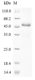 (Tris-Glycine gel) Discontinuous SDS-PAGE (reduced) with 5% enrichment gel and 15% separation gel.