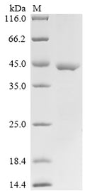 (Tris-Glycine gel) Discontinuous SDS-PAGE (reduced) with 5% enrichment gel and 15% separation gel.