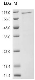 (Tris-Glycine gel) Discontinuous SDS-PAGE (reduced) with 5% enrichment gel and 15% separation gel.