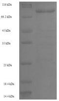 Recombinant Human Polypeptide N-acetylgalactosaminyltransferase 14 (GALNT14) – Figure 1 of 1