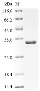 (Tris-Glycine gel) Discontinuous SDS-PAGE (reduced) with 5% enrichment gel and 15% separation gel.