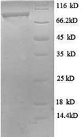 Recombinant Human Probable ATP-dependent RNA helicase DDX27 (DDX27), partial – Figure 1 of 1
