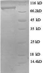 Recombinant Human Probable ATP-dependent RNA helicase DDX27 (DDX27), partial – Figure 1 of 1