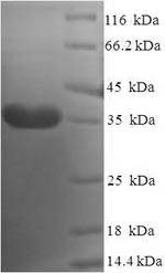 Recombinant Human DPY30 domain-containing protein 2 (DYDC2) – Figure 1 of 1