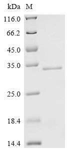 (Tris-Glycine gel) Discontinuous SDS-PAGE (reduced) with 5% enrichment gel and 15% separation gel.