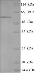 Recombinant Human Regulator of microtubule dynamics protein 3 (RMDN3) – Figure 1 of 1