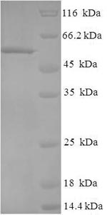 Recombinant Human Regulator of microtubule dynamics protein 3 (RMDN3) – Figure 1 of 1