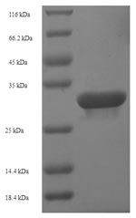Recombinant Human Guanosine-3',5'-bis (diphosphate) 3'-pyrophosphohydrolase MESH1 (HDDC3) – Figure 1 of 1