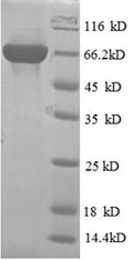 Recombinant Human Inactive phospholipase D5 (PLD5) – Figure 1 of 1