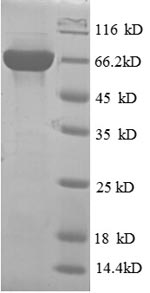 Recombinant Human Inactive phospholipase D5 (PLD5) – Figure 1 of 1