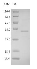 (Tris-Glycine gel) Discontinuous SDS-PAGE (reduced) with 5% enrichment gel and 15% separation gel.
