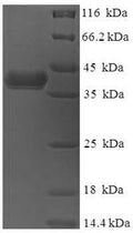 Recombinant Human DnaJ homolog subfamily B member 8 (DNAJB8) – Figure 1 of 1