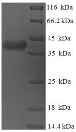 Recombinant Human DnaJ homolog subfamily B member 8 (DNAJB8) – Figure 1 of 1