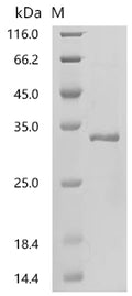 (Tris-Glycine gel) Discontinuous SDS-PAGE (reduced) with 5% enrichment gel and 15% separation gel.