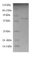Recombinant Human THAP domain-containing protein 6 (THAP6) – Figure 1 of 1