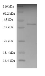 Recombinant Human THAP domain-containing protein 6 (THAP6) – Figure 1 of 1