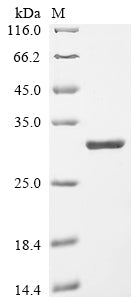 (Tris-Glycine gel) Discontinuous SDS-PAGE (reduced) with 5% enrichment gel and 15% separation gel.