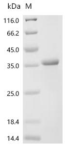(Tris-Glycine gel) Discontinuous SDS-PAGE (reduced) with 5% enrichment gel and 15% separation gel.