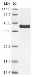 (Tris-Glycine gel) Discontinuous SDS-PAGE (reduced) with 5% enrichment gel and 15% separation gel.