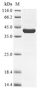 (Tris-Glycine gel) Discontinuous SDS-PAGE (reduced) with 5% enrichment gel and 15% separation gel.