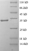 Recombinant Human Interleukin-1 family member 10 (IL1F10) – Figure 1 of 1