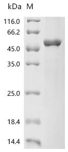 (Tris-Glycine gel) Discontinuous SDS-PAGE (reduced) with 5% enrichment gel and 15% separation gel.